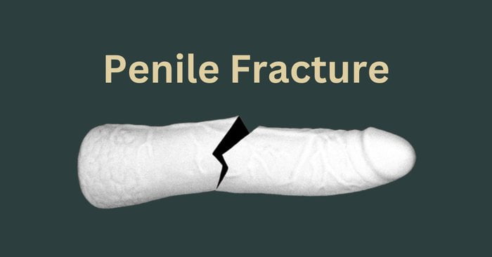 penile fracture in hindi